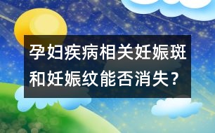 孕婦疾病相關(guān)：妊娠斑和妊娠紋能否消失？