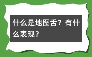 什么是地圖舌？有什么表現(xiàn)？