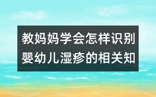 教媽媽學(xué)會(huì)怎樣識(shí)別嬰幼兒濕疹的相關(guān)知識(shí)