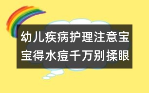 幼兒疾病護(hù)理注意：寶寶得水痘千萬別揉眼睛