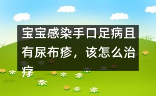 寶寶感染手口足病且有尿布疹，該怎么治療