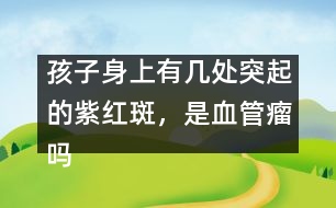 孩子身上有幾處突起的紫紅斑，是血管瘤嗎