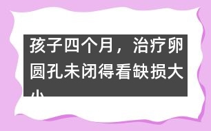 孩子四個(gè)月，治療卵圓孔未閉得看缺損大小